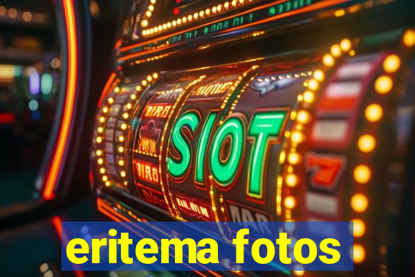 eritema fotos